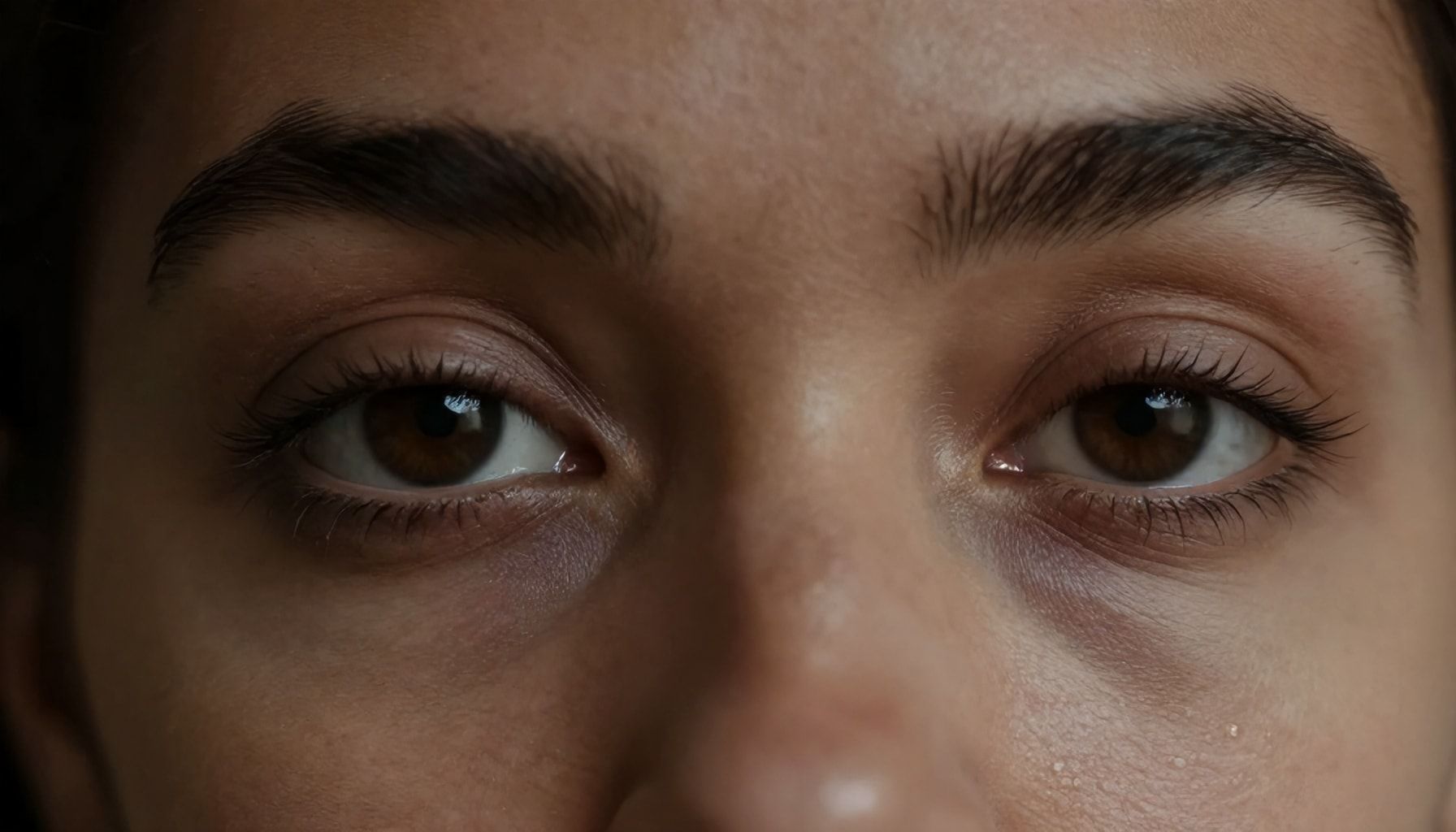 The Truth About Dark Circles: Causes, Symptoms, and Prevention